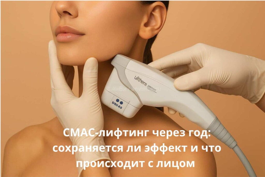 Результат СМАС-лифтинга лица спустя 12 месяцев