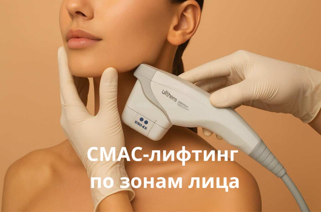 Зоны СМАС-лифтинга лица