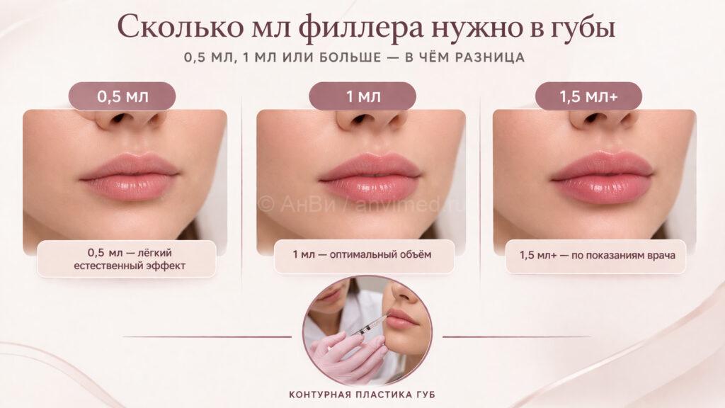 Сколько мл филлера нужно в губы — 0,5 мл, 1 мл или больше