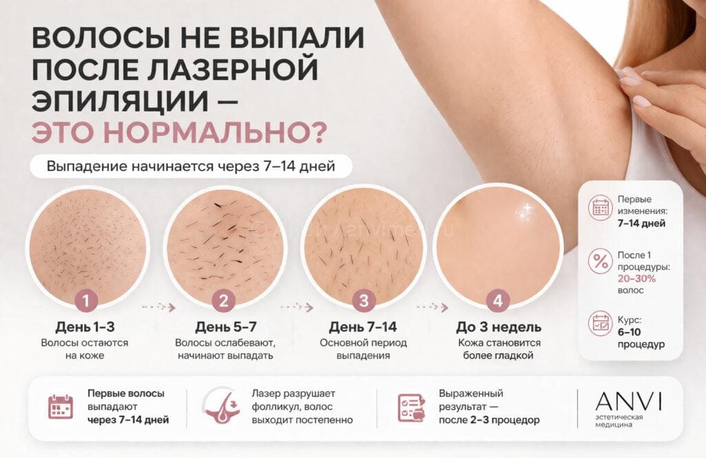 Волосы не выпали после лазерной эпиляции — это нормально?