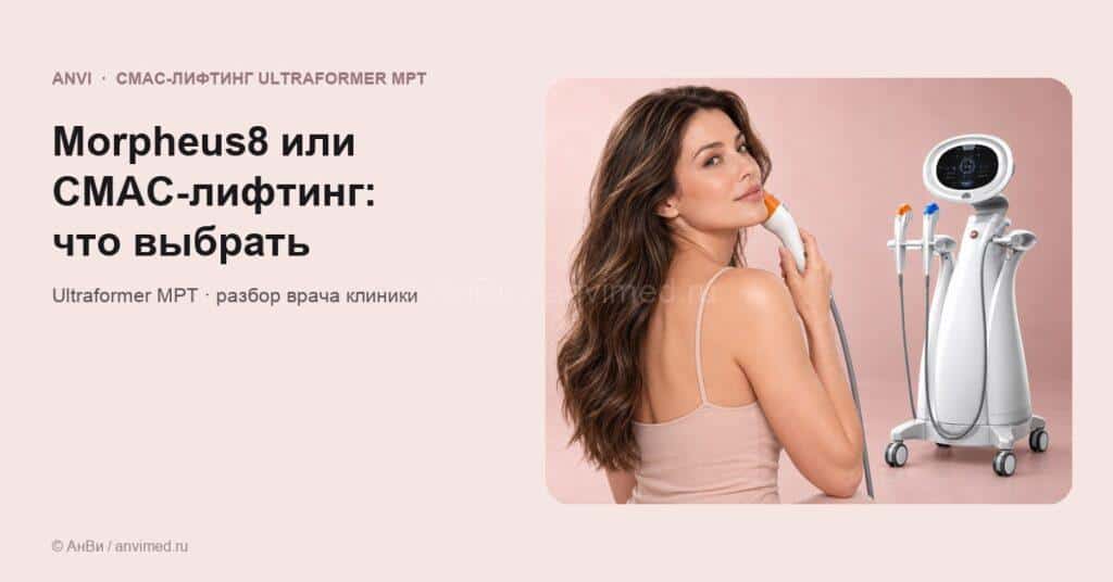 Микроигольчатый RF (Morpheus8) или СМАС-лифтинг: что выбрать