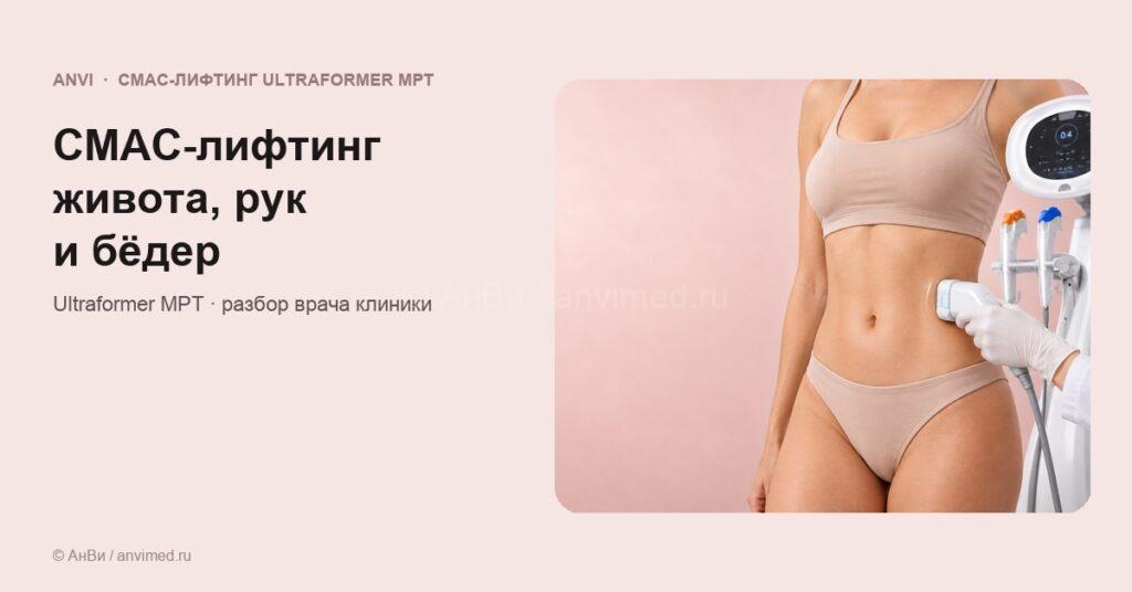 СМАС-лифтинг живота, рук, бёдер и колен на Ultraformer MPT