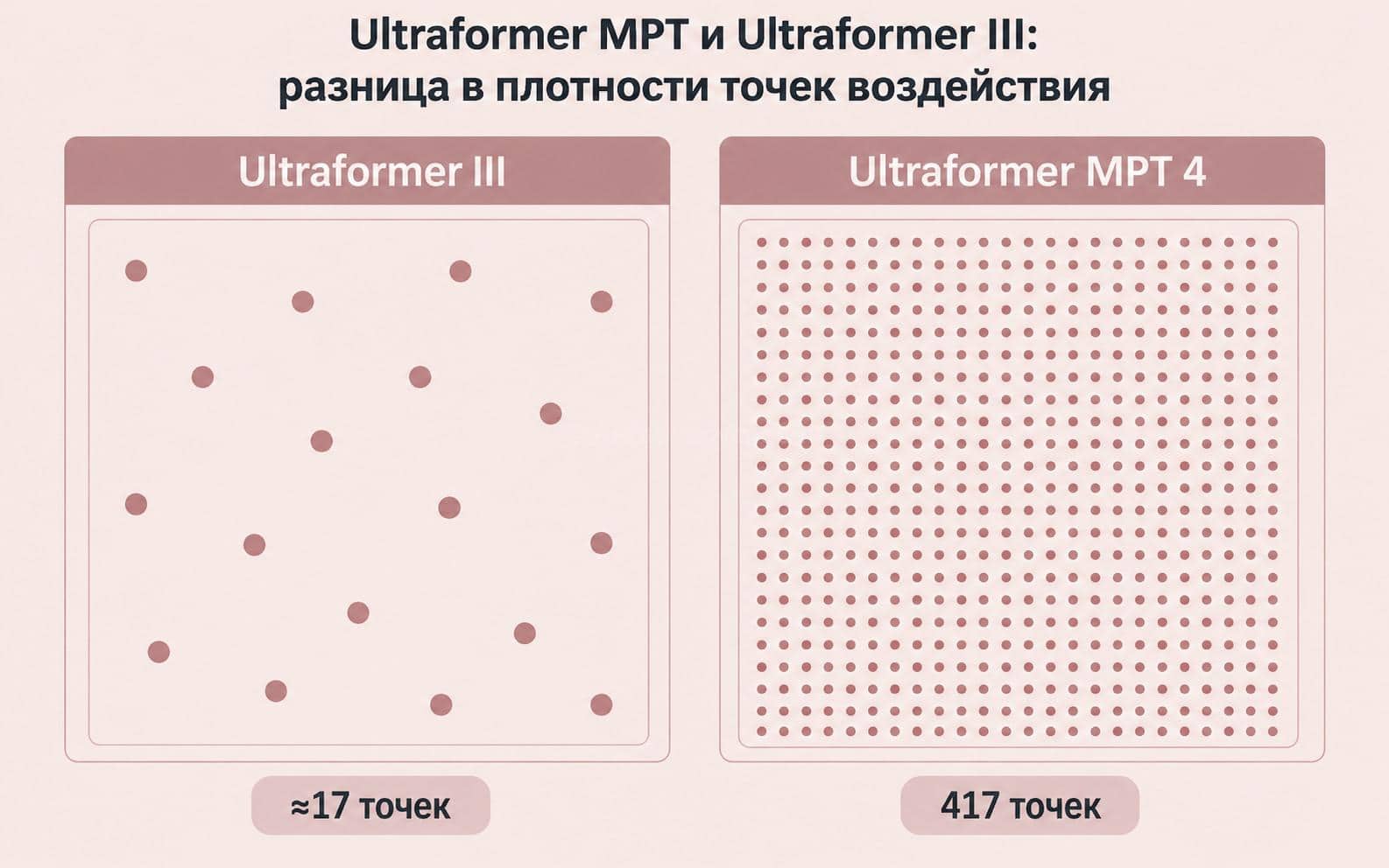 Схема сравнения плотности точек воздействия: Ultraformer III около 17 точек, Ultraformer MPT 4 до 417 точек за проход насадки